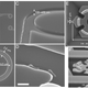 Image for article titled Where Are My Medical Nanobots?